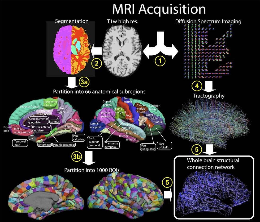 Connectome extraction procedure diagram showing how brain imaging becomes a network graph. Image: Wikimedia Commons / Hagmann P, Cammoun L, Gigandet X, Meuli R, Honey CJ, et al / CC BY 3.0