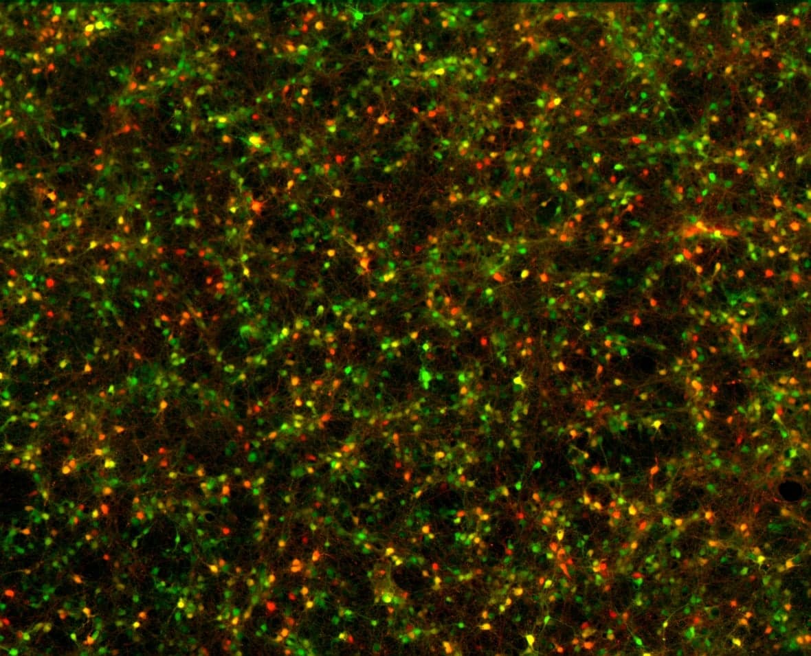 Agentic AI glossary 2026: a fluorescence microscopy image of a dense network of cortical neurons, the biological network that gave AI words like neuron, attention, and memory