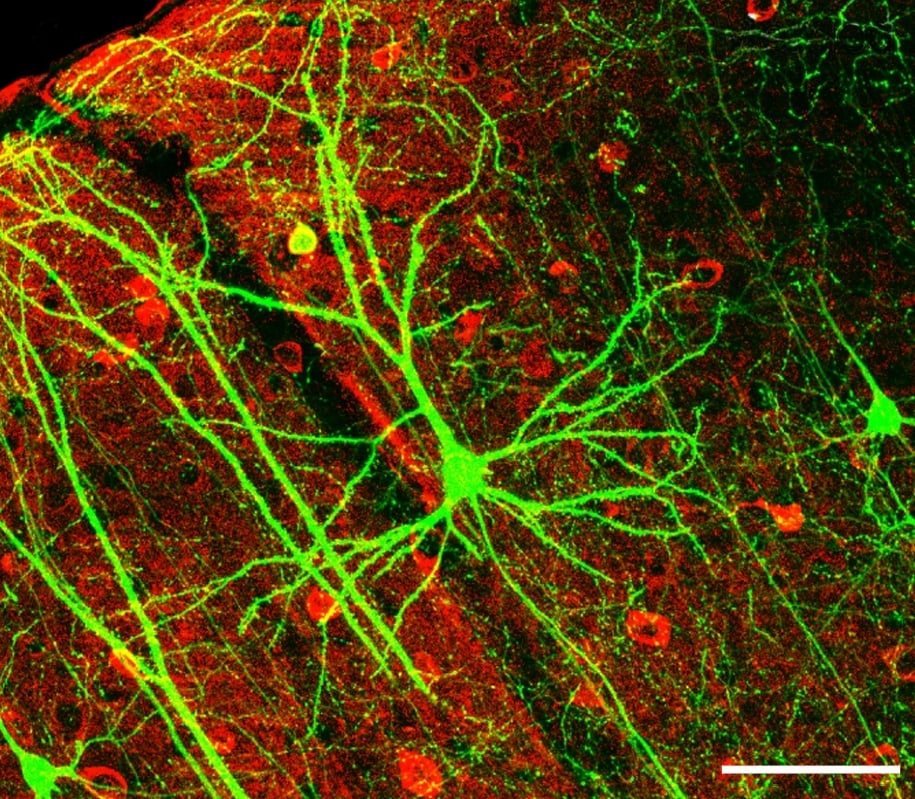 A neuron in brain tissue under fluorescence microscopy, with its dendrites branching out to receive thousands of synaptic inputs